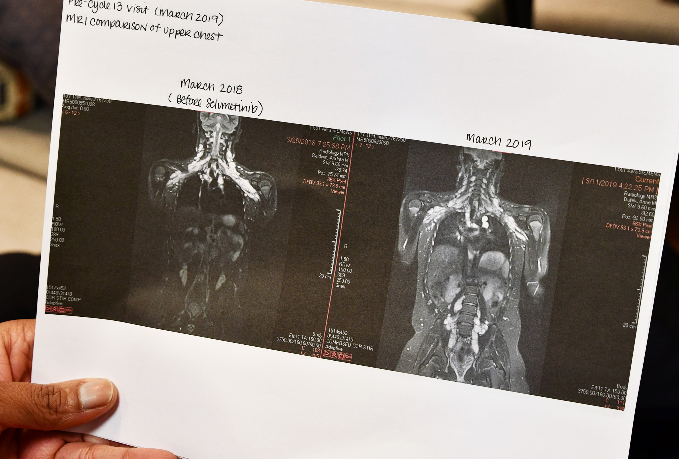 Xaviers body scan x-rays
